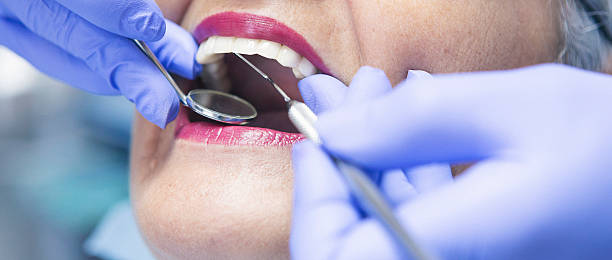 Best Knocked-Out Tooth Emergency  in Lake Magdalene, FL